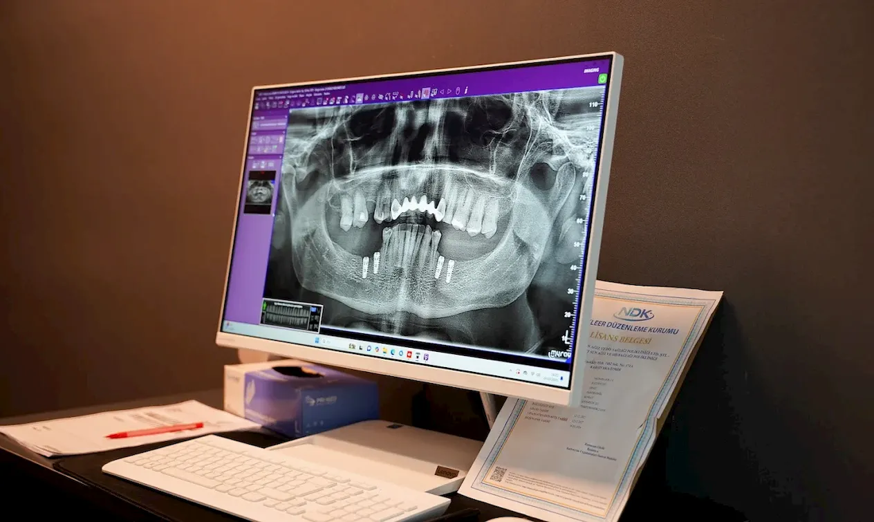 dentsun4