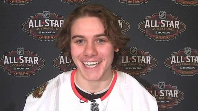 jack hughes teeth 2022