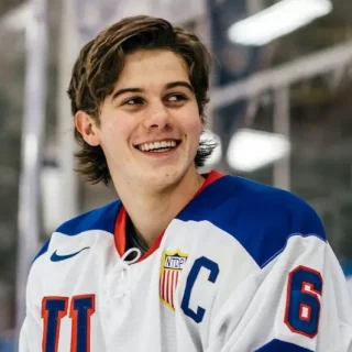 jack hughes teeth 2026