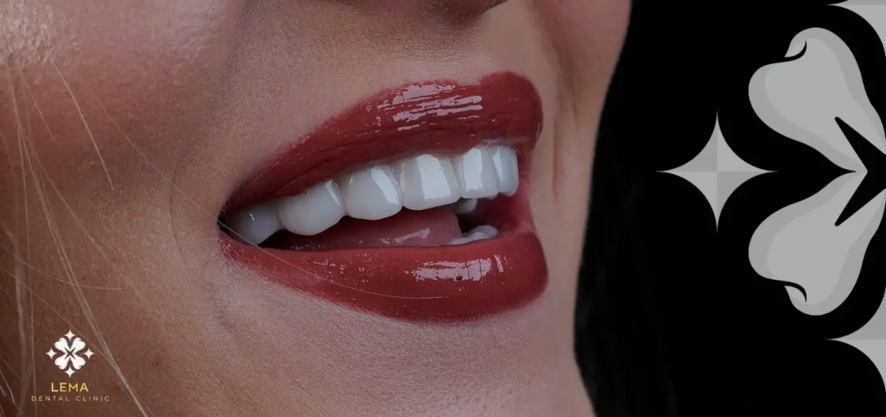 smile hollywood patient 10