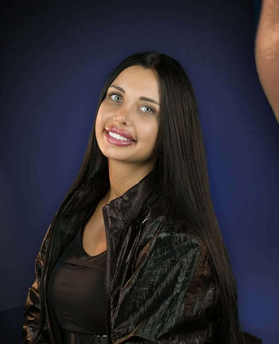 smile hollywood patient 19