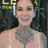 smile hollywood patient 31