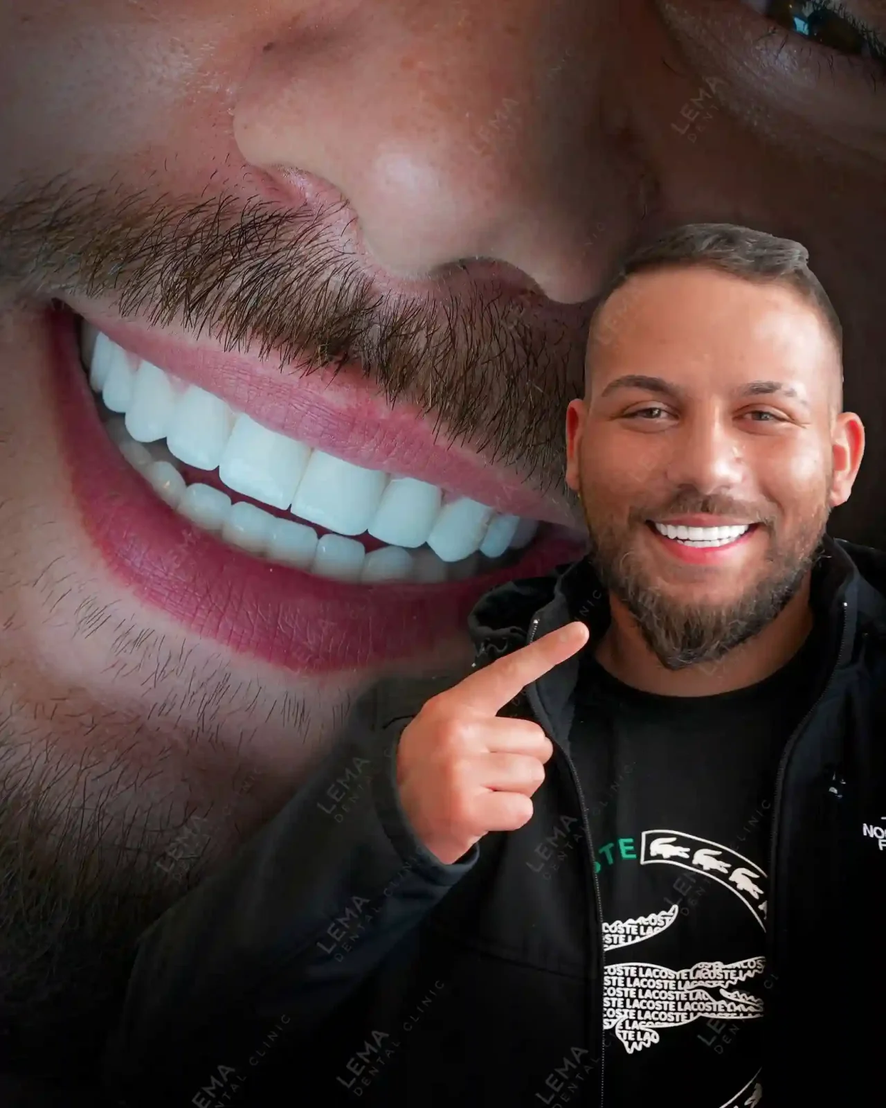 smile hollywood patient 37