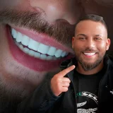 smile hollywood patient 37