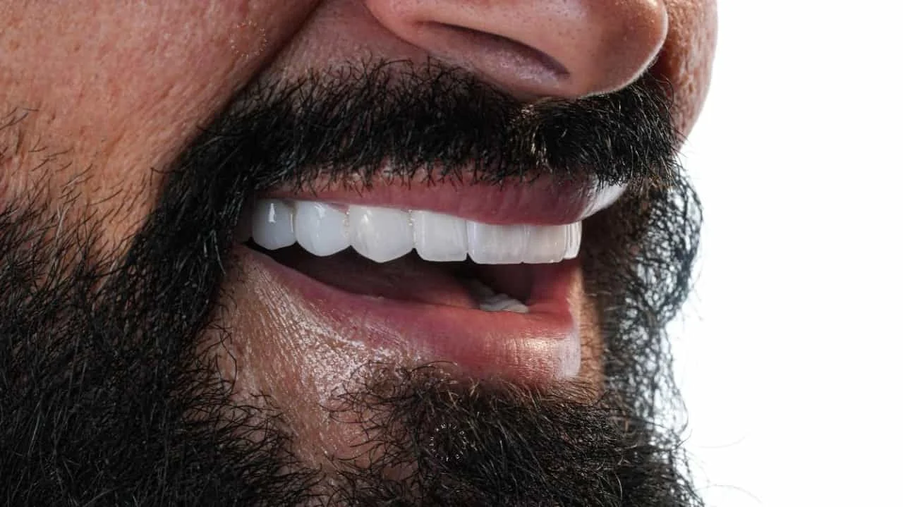 smile hollywood patient 40