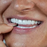 smile hollywood patient 47
