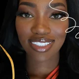 smile hollywood patient 49