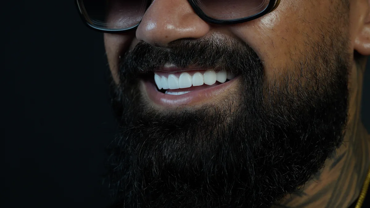 smile hollywood patient 62