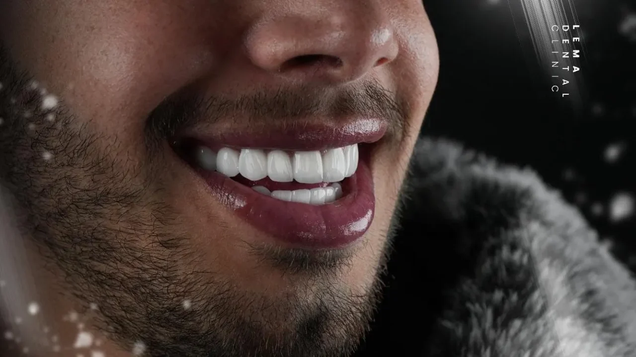 smile hollywood patient 70