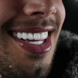 smile hollywood patient 70