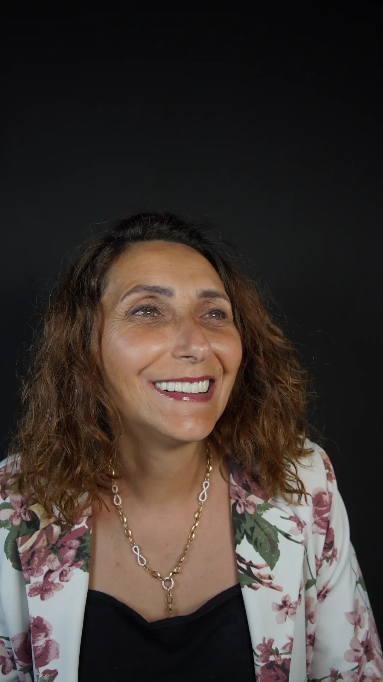 smile hollywood patient 79