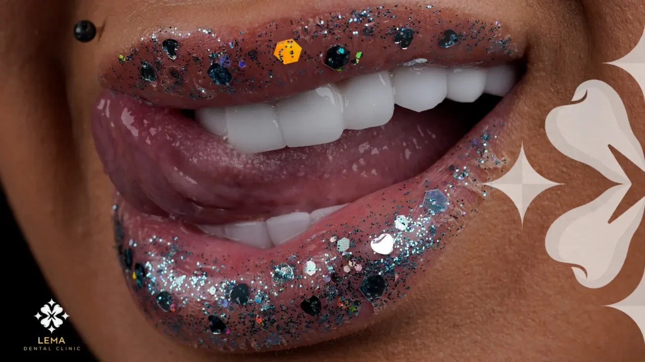 smile hollywood patient 84