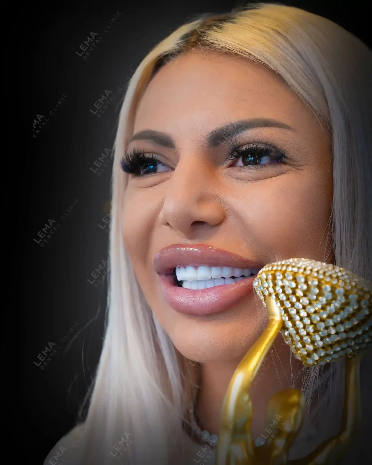 smile hollywood patient 9
