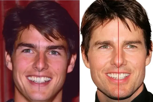 tom cruise teeth 2026 teethline