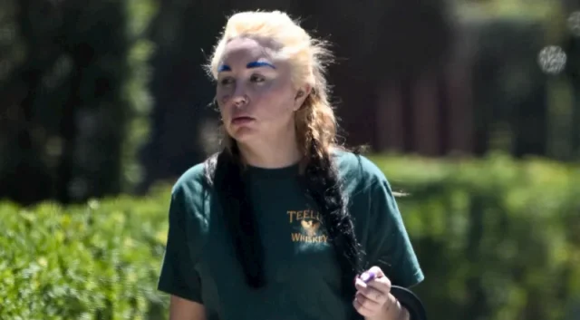 amanda bynes teeth in 2026 amanda bynes teeth in 2026