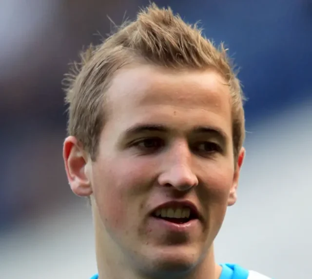 harry kane teeth in 2010 harry kane teeth in 2010