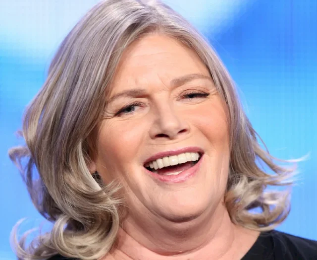 kelly mcgillis teeth in 2026 kelly mcgillis teeth in 2026
