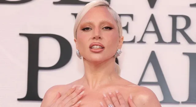 lady gaga teeth in 2026 lady gaga teeth in 2026