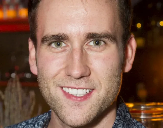 matthew lewis teeth in 2026 matthew lewis teeth in 2026