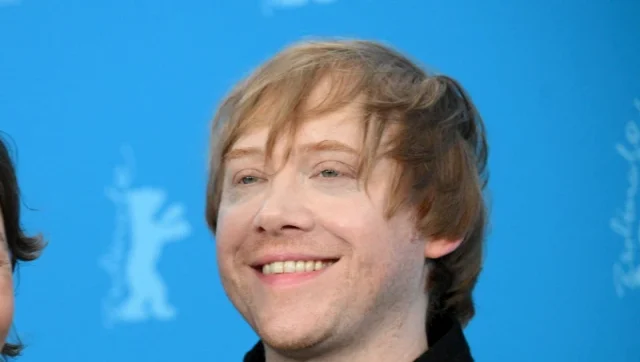 rupert grint teeth in 2026 rupert grint teeth in 2026