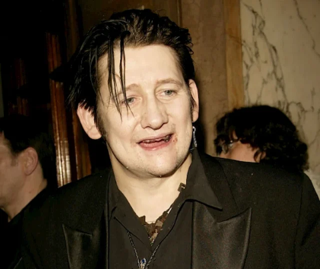 shane macgowan teeth in 2005 shane macgowan teeth in 2005