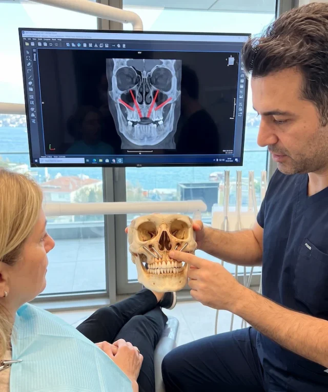 trans nasal dental implants in turkey 1 trans nasal dental implants in turkey 1