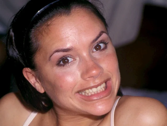 victoria beckham teeth in 1995 victoria beckham teeth in 1995