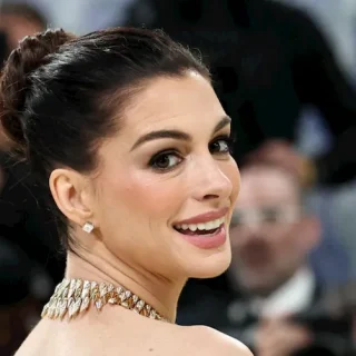 anne hathaway teeth in 2026