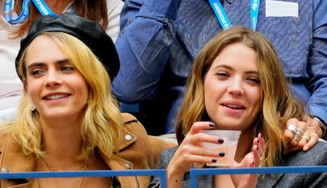 cara delevingne teeth in 2020