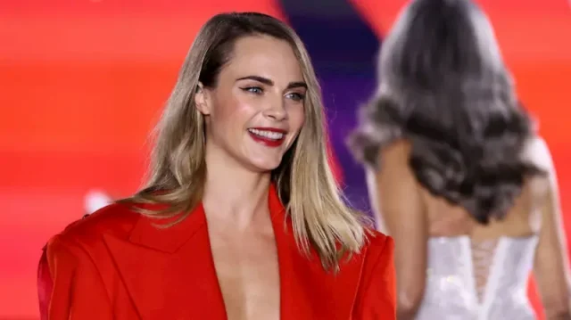cara delevingne teeth in 2024
