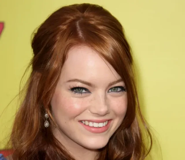emma stone teeth in 2007 emma stone teeth in 2007