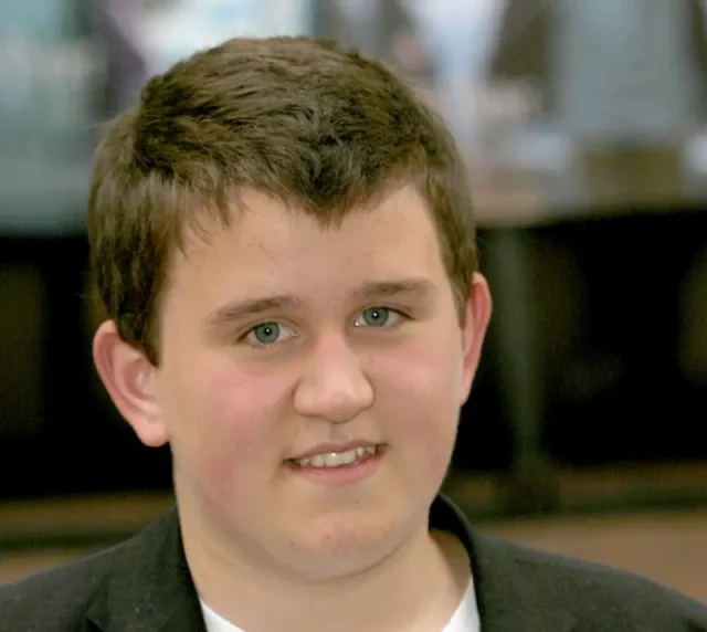 harry melling teeth in 2003 harry melling teeth in 2003