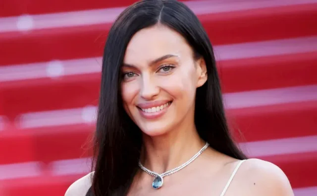 irina shayk teeth in 2026