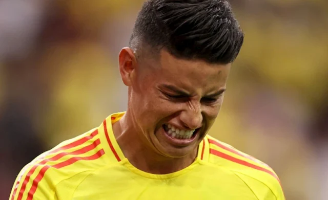james rodriguez teeth in 2024 james rodriguez teeth in 2024