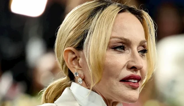 madonna teeth in 2026 madonna teeth in 2026
