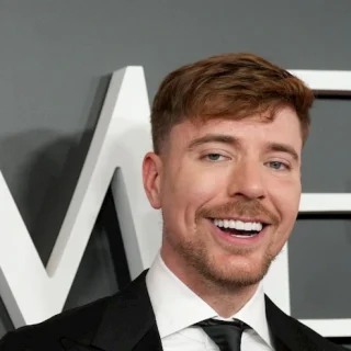 MrBeast Teeth Before and After: What Happened To His Teeth? mr beast teeth in 2026