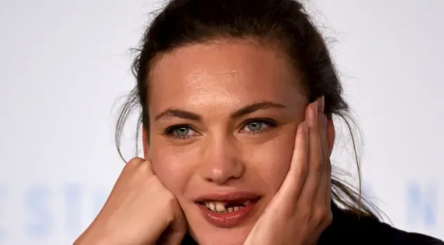 aomi muyock teeth in 2015