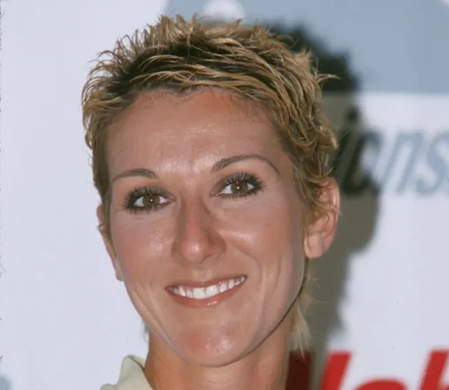 celine dion teeth in 2000 celine dion teeth in 2000