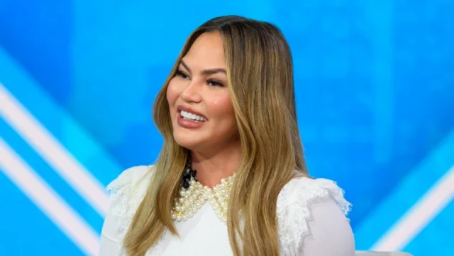 chrissy teigen teeth in 2020 chrissy teigen teeth in 2020