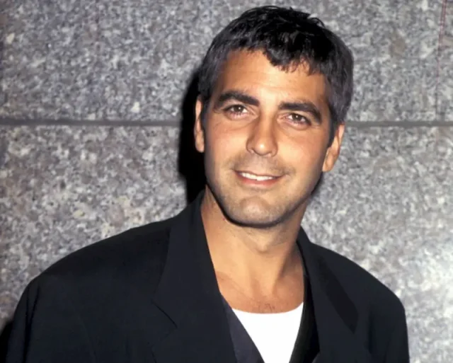 george clooney teeth in 1995