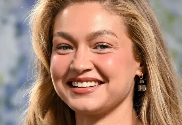 gigi hadid teeth in 2026