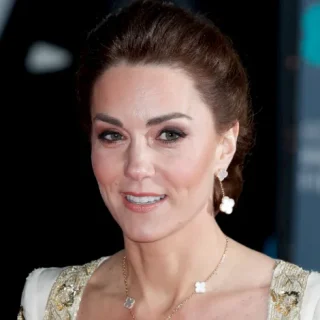 Kate Middleton Teeth: The Secret to a Royal Aesthetic kate middleton teeth in 2020