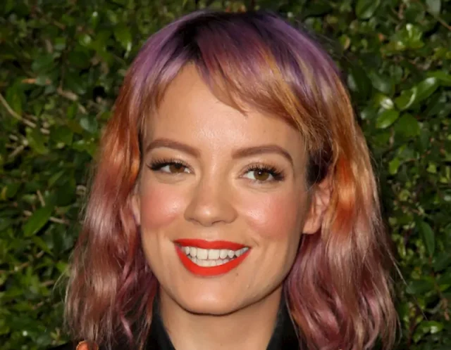 lily allen teeth in 2015