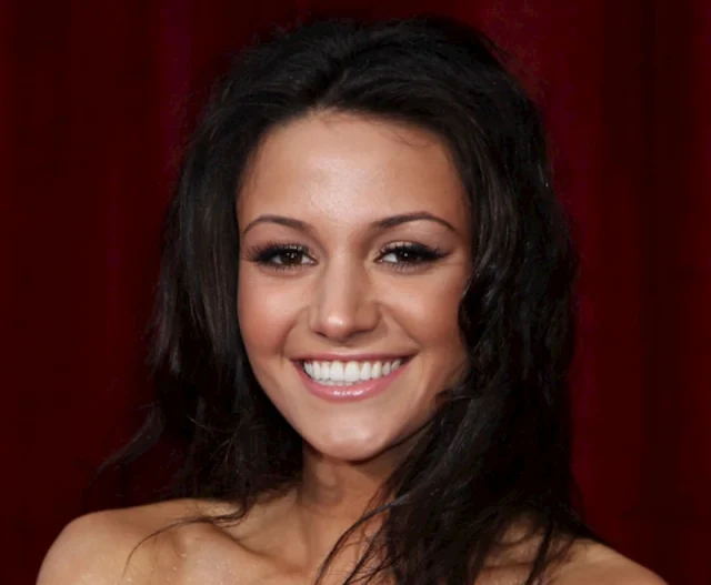 michelle keegan teeth in 2010