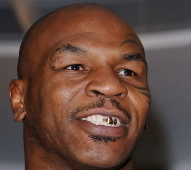 mike tyson teeth in 2005