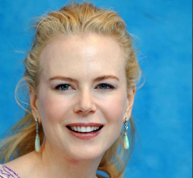 nicole kidman teeth in 2005