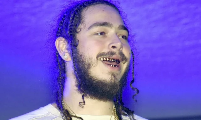 post malone teeth in 2015