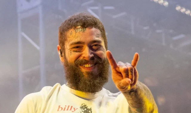 post malone teeth in 2023
