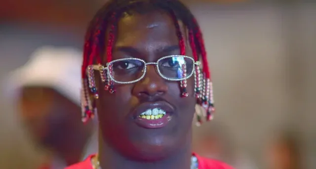 lil yachty teeth in 2020